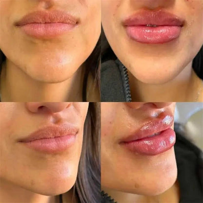 Crema rimpolpante per labbra Plumpe istantaneamente le labbra Aumenta